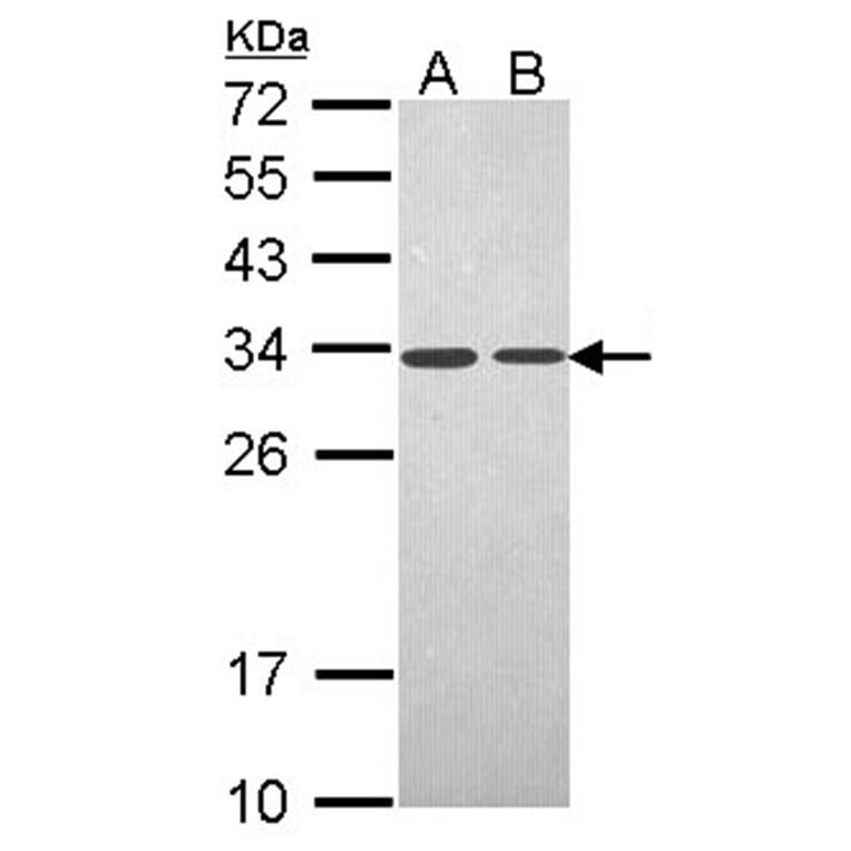 PSME3 antibody from Signalway Antibody (22679) - Antibodies.com