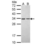 PSME3 antibody from Signalway Antibody (22679) - Antibodies.com