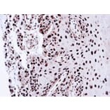 Immunohistochemistry - PSME3 antibody from Signalway Antibody (22679) - Antibodies.com