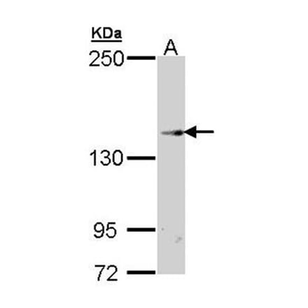 TRPM2 antibody from Signalway Antibody (22689) - Antibodies.com