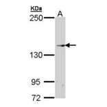 TRPM2 antibody from Signalway Antibody (22689) - Antibodies.com