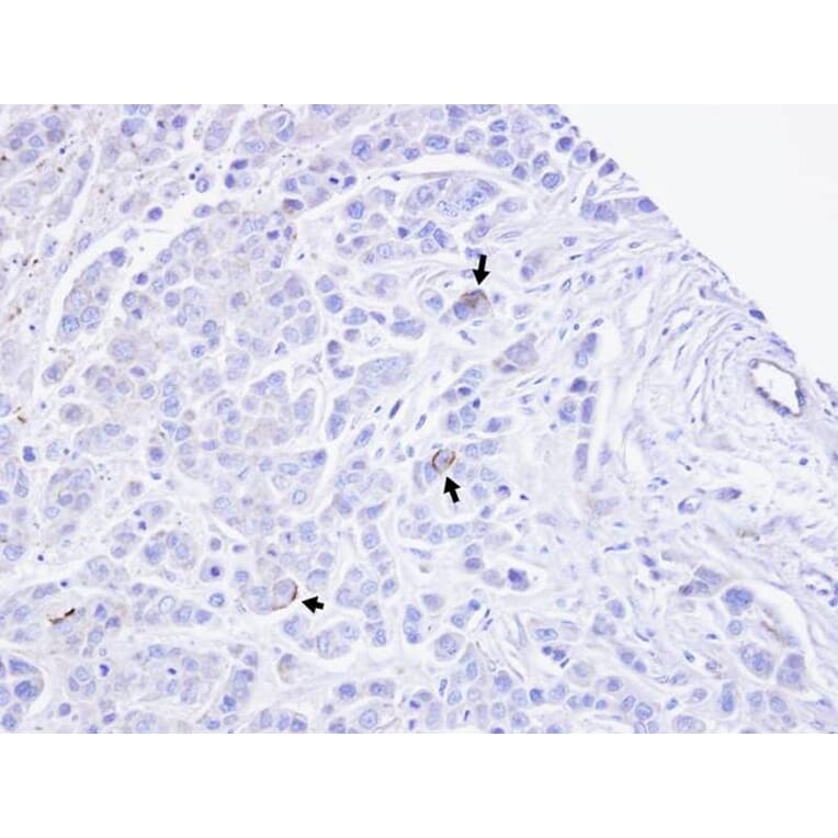 Immunohistochemistry - TRPM2 antibody from Signalway Antibody (22689) - Antibodies.com