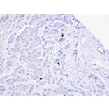 Immunohistochemistry - TRPM2 antibody from Signalway Antibody (22689) - Antibodies.com