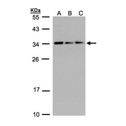 CIP29 antibody from Signalway Antibody (22699) - Antibodies.com