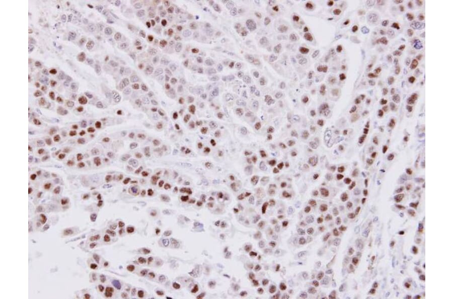 Immunohistochemistry - CIP29 antibody from Signalway Antibody (22699) - Antibodies.com