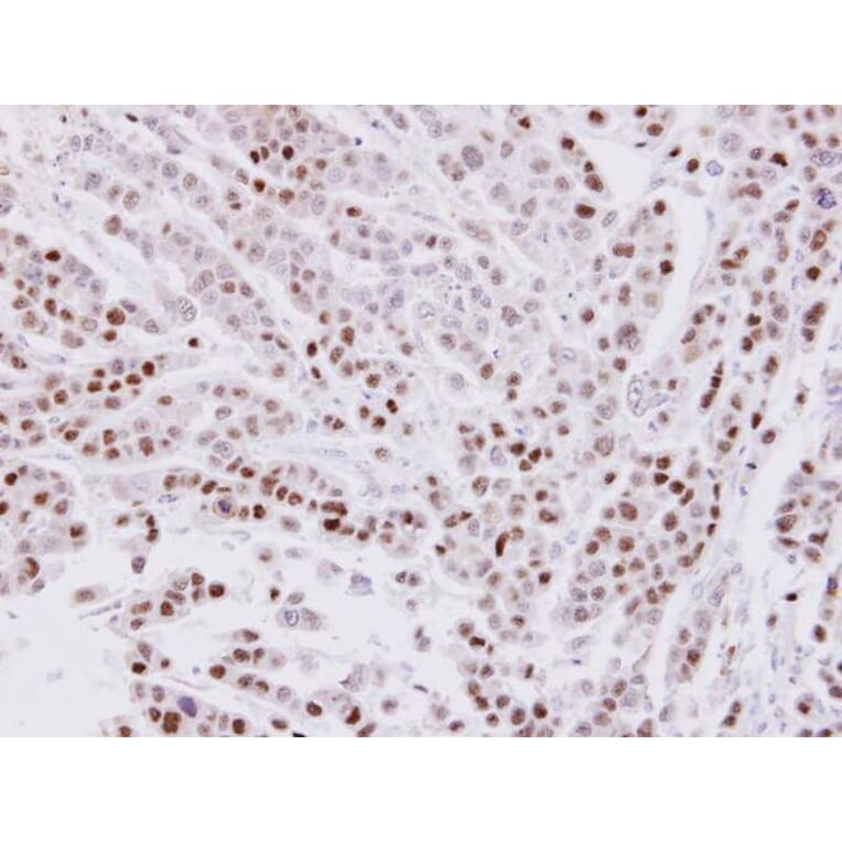 Immunohistochemistry - CIP29 antibody from Signalway Antibody (22699) - Antibodies.com