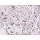 Immunohistochemistry - CIP29 antibody from Signalway Antibody (22699) - Antibodies.com