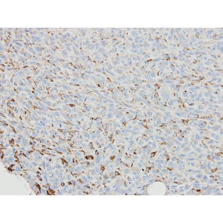 Immunohistochemistry - SNX18 antibody from Signalway Antibody (22720) - Antibodies.com