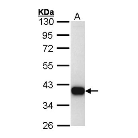 TTLL1 antibody from Signalway Antibody (22726) - Antibodies.com