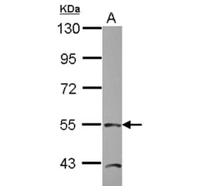 TEAD4 antibody from Signalway Antibody (22749) - Antibodies.com