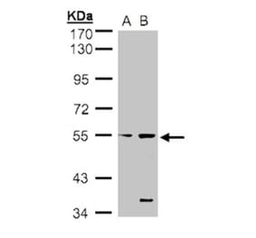 STYK1 antibody from Signalway Antibody (22780) - Antibodies.com