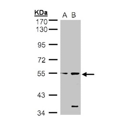 STYK1 antibody from Signalway Antibody (22780) - Antibodies.com