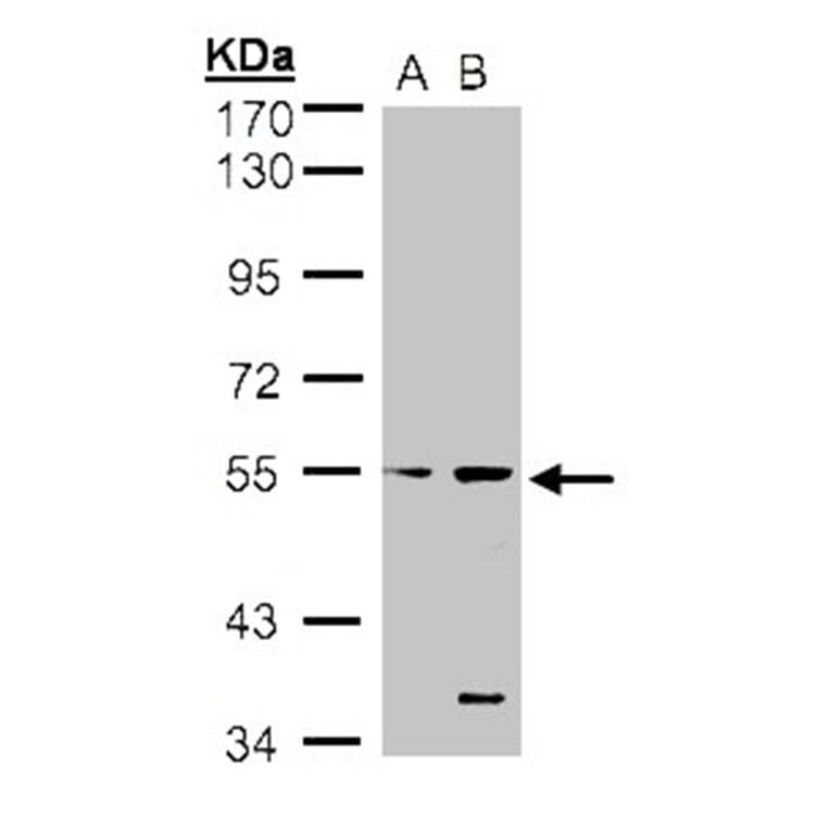 STYK1 antibody from Signalway Antibody (22780) - Antibodies.com