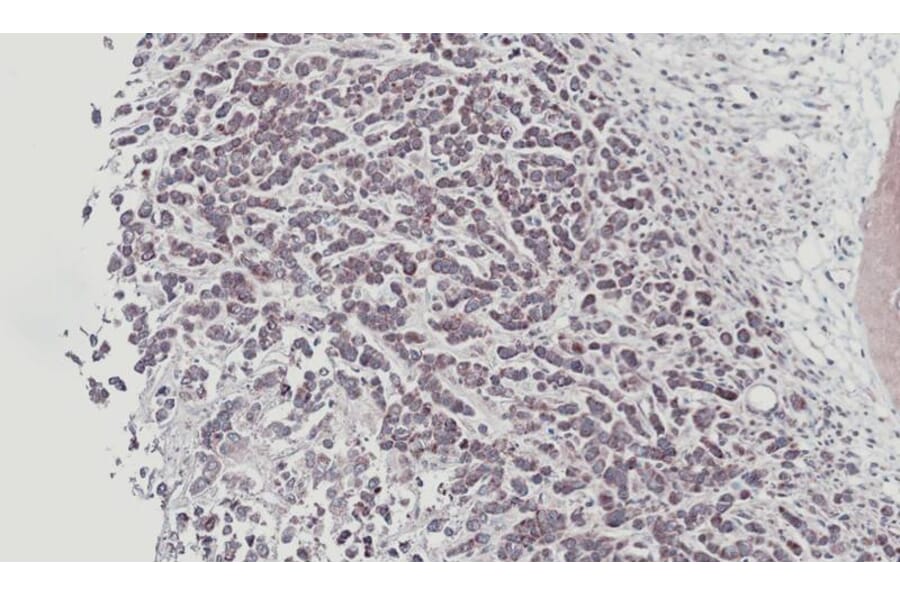 Immunohistochemistry - STYK1 antibody from Signalway Antibody (22780) - Antibodies.com