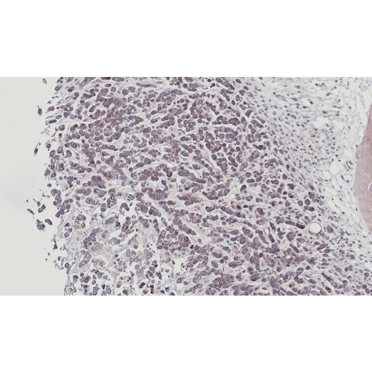 Immunohistochemistry - STYK1 antibody from Signalway Antibody (22780) - Antibodies.com