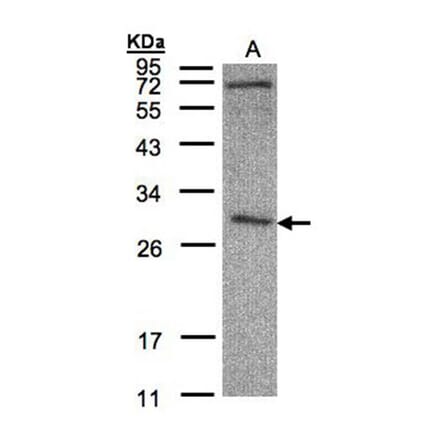 CLIC3 antibody from Signalway Antibody (22792) - Antibodies.com