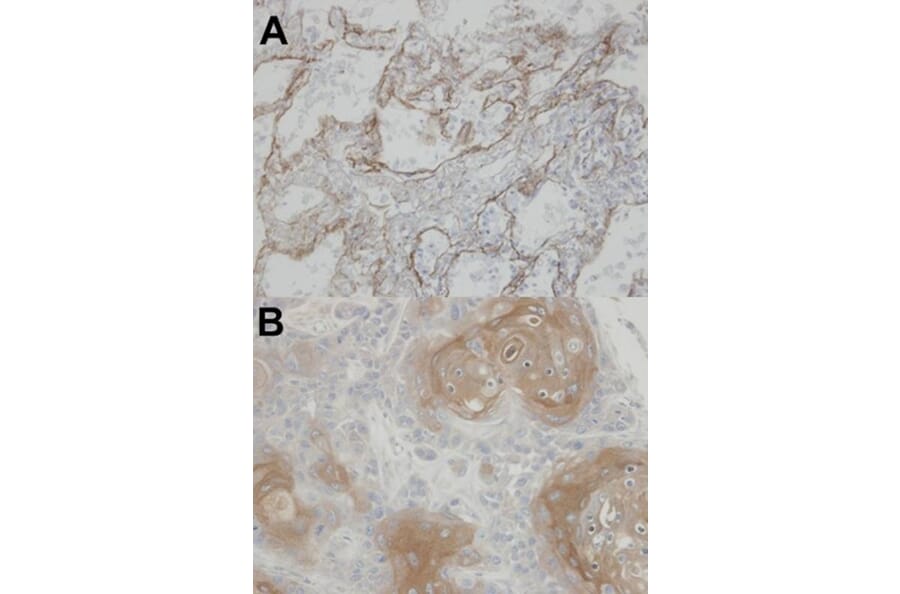 Immunohistochemistry - CLIC3 antibody from Signalway Antibody (22792) - Antibodies.com