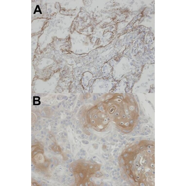 Immunohistochemistry - CLIC3 antibody from Signalway Antibody (22792) - Antibodies.com