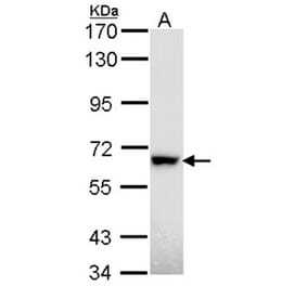 RAD18 antibody from Signalway Antibody (22872) - Antibodies.com