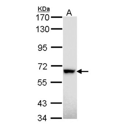 RAD18 antibody from Signalway Antibody (22872) - Antibodies.com