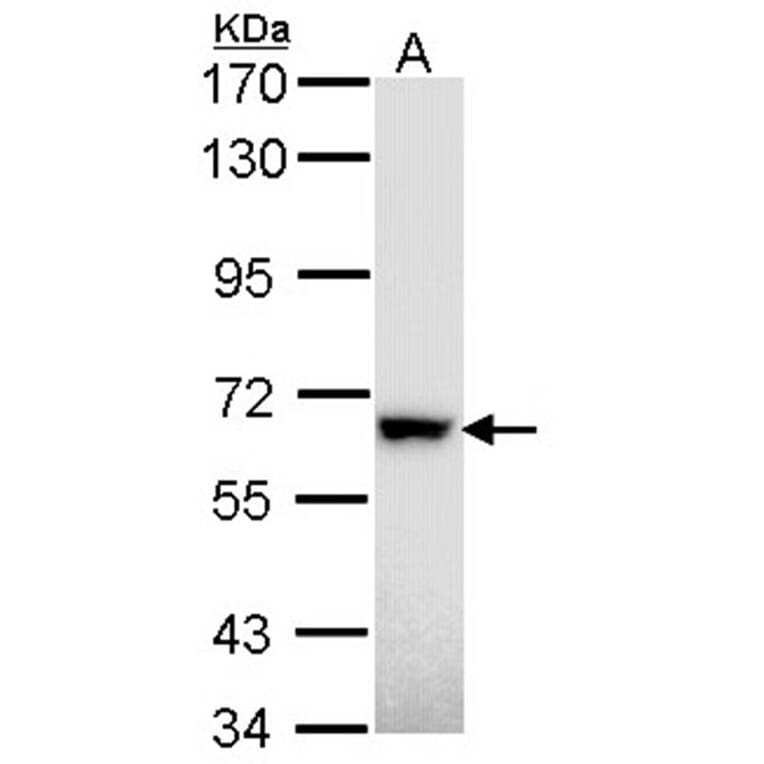 RAD18 antibody from Signalway Antibody (22872) - Antibodies.com