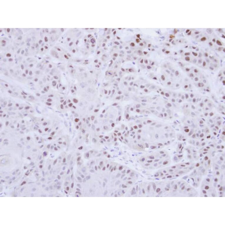 Immunohistochemistry - RAD18 antibody from Signalway Antibody (22872) - Antibodies.com