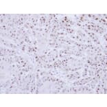 Immunohistochemistry - RAD18 antibody from Signalway Antibody (22872) - Antibodies.com