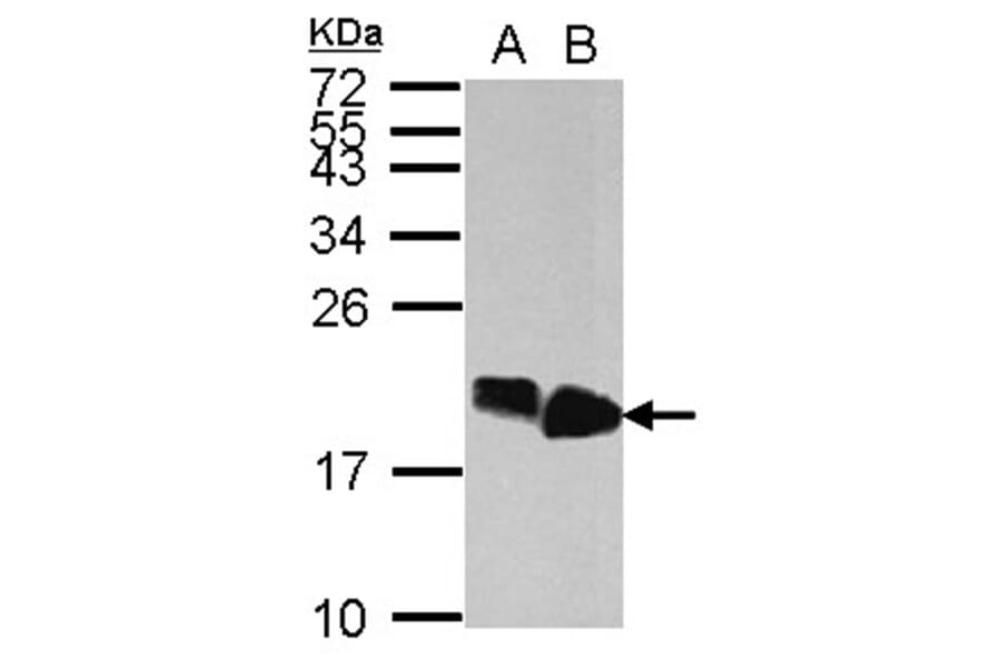 HMGA2 antibody from Signalway Antibody (22874) - Antibodies.com