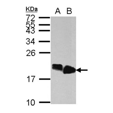 HMGA2 antibody from Signalway Antibody (22874) - Antibodies.com