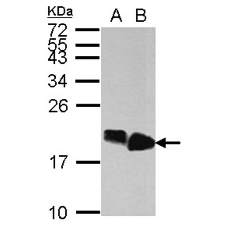 HMGA2 antibody from Signalway Antibody (22874) - Antibodies.com