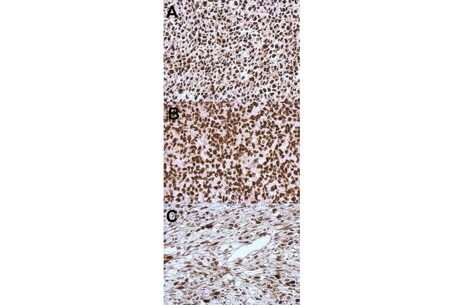Immunohistochemistry - HMGA2 antibody from Signalway Antibody (22874) - Antibodies.com