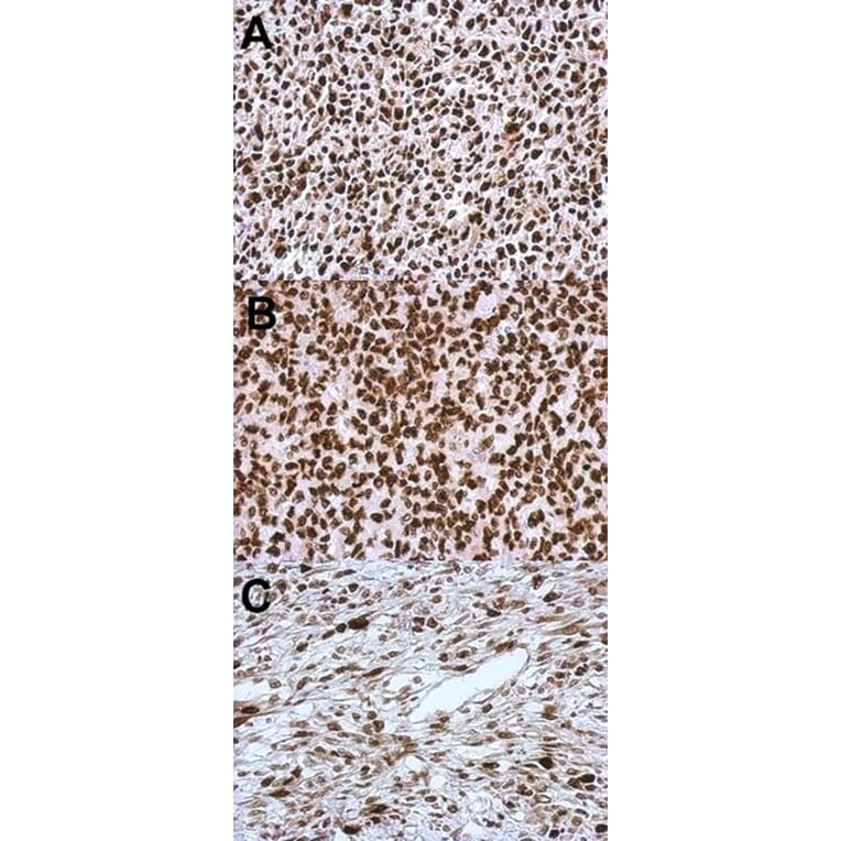 Immunohistochemistry - HMGA2 antibody from Signalway Antibody (22874) - Antibodies.com