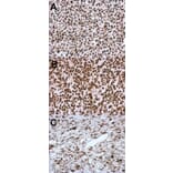 Immunohistochemistry - HMGA2 antibody from Signalway Antibody (22874) - Antibodies.com