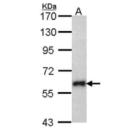 SOCS5 antibody from Signalway Antibody (22879) - Antibodies.com