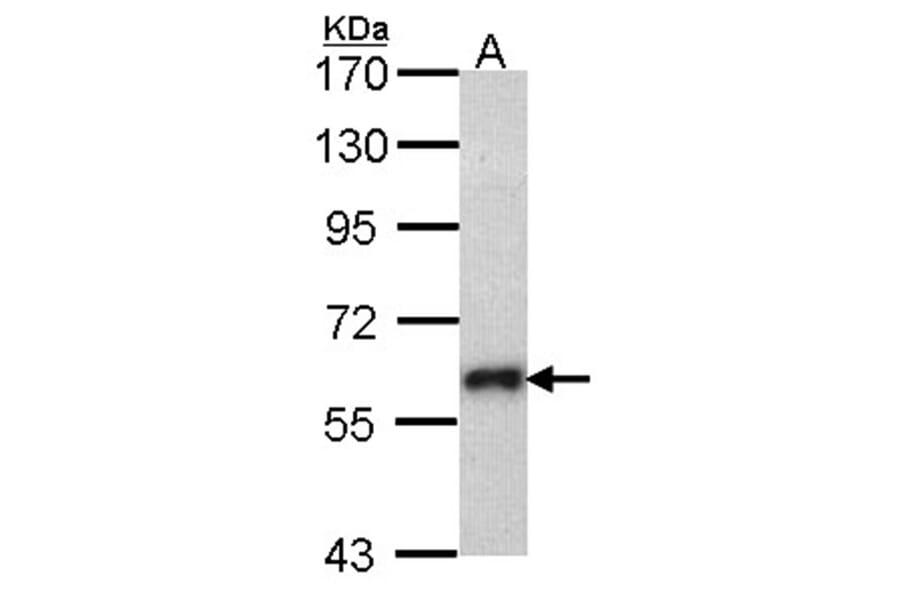SOCS5 antibody from Signalway Antibody (22879) - Antibodies.com