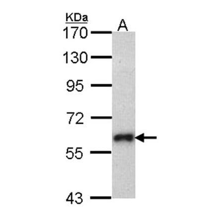 SOCS5 antibody from Signalway Antibody (22879) - Antibodies.com