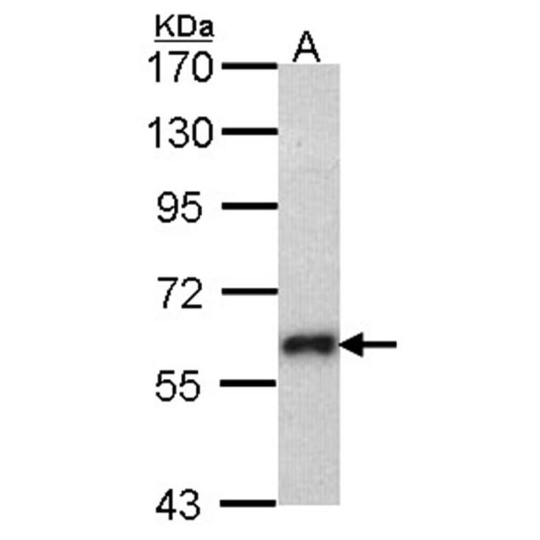 SOCS5 antibody from Signalway Antibody (22879) - Antibodies.com