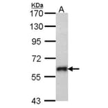 SOCS5 antibody from Signalway Antibody (22879) - Antibodies.com
