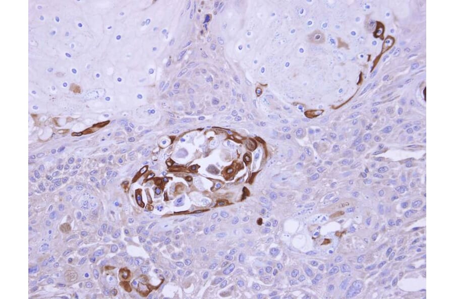 Immunohistochemistry - SOCS5 antibody from Signalway Antibody (22879) - Antibodies.com