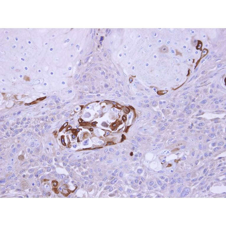 Immunohistochemistry - SOCS5 antibody from Signalway Antibody (22879) - Antibodies.com