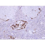 Immunohistochemistry - SOCS5 antibody from Signalway Antibody (22879) - Antibodies.com