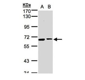 SENP2 antibody from Signalway Antibody (22882) - Antibodies.com