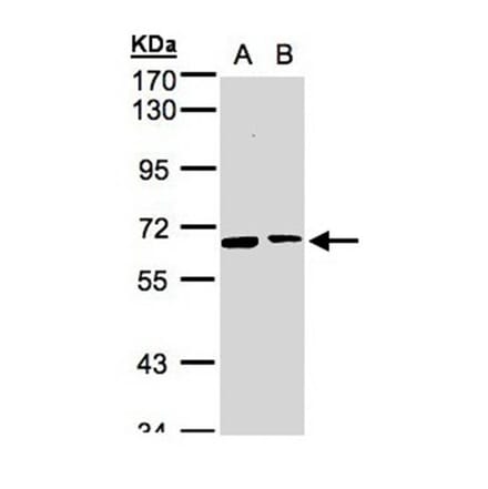 SENP2 antibody from Signalway Antibody (22882) - Antibodies.com