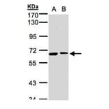 SENP2 antibody from Signalway Antibody (22882) - Antibodies.com