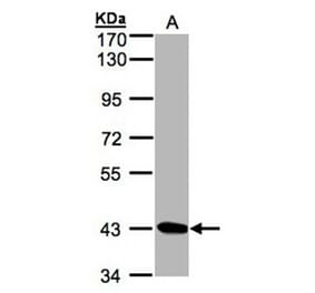 DRAK1 antibody from Signalway Antibody (22934) - Antibodies.com