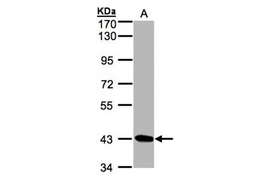 DRAK1 antibody from Signalway Antibody (22934) - Antibodies.com