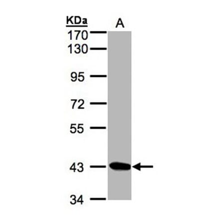 DRAK1 antibody from Signalway Antibody (22934) - Antibodies.com