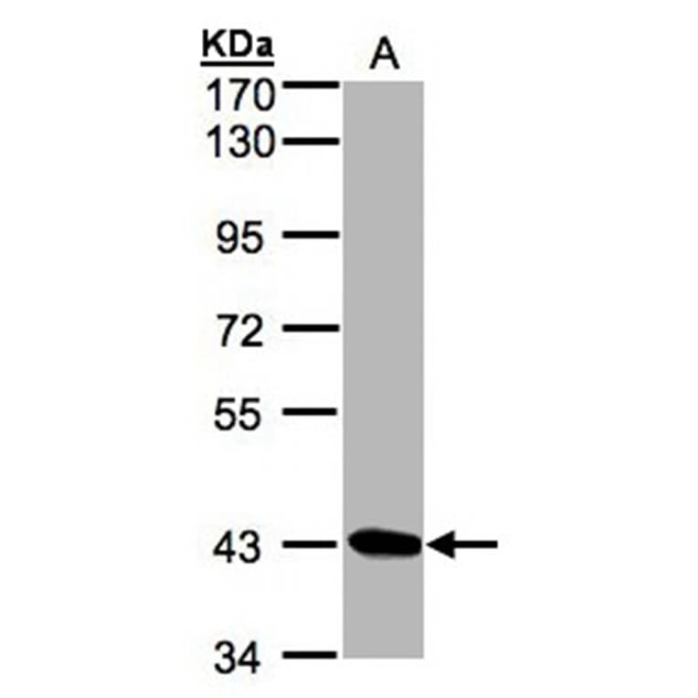 DRAK1 antibody from Signalway Antibody (22934) - Antibodies.com