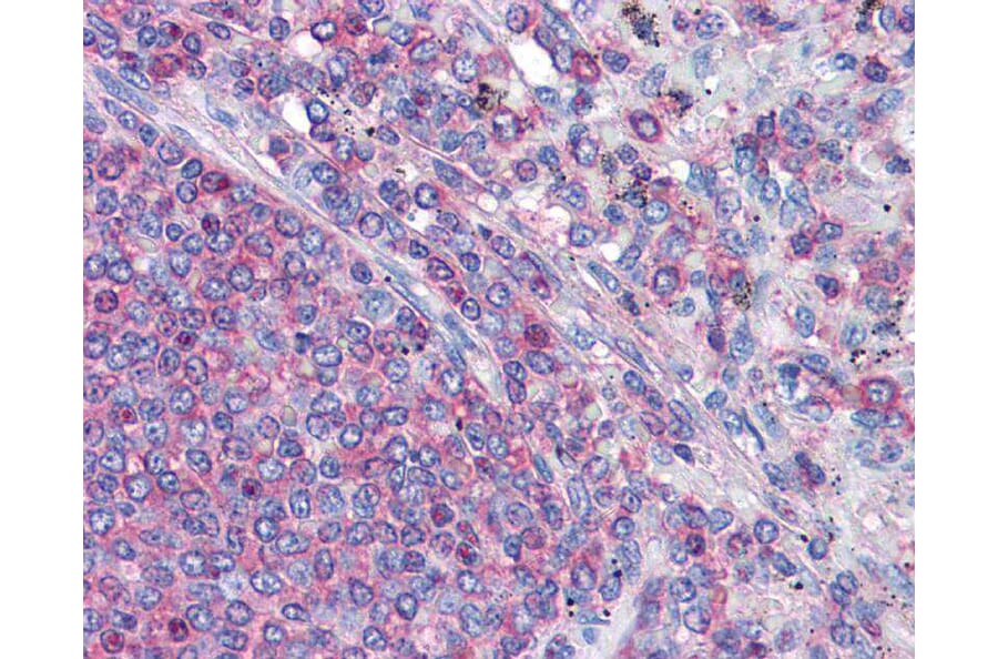 Immunohistochemistry - Actin antibody from Signalway Antibody (22959) - Antibodies.com
