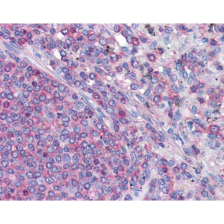 Immunohistochemistry - Actin antibody from Signalway Antibody (22959) - Antibodies.com